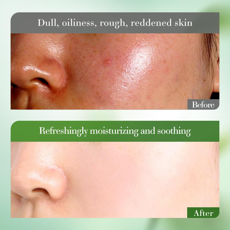 Aloe Vera Beauty Успокаивающий увлажняющий роскошный набор из 6 предметов для отбеливания, устранения морщин, антивозрастного ухода за кожей Уход за светлой и проблемной кожей