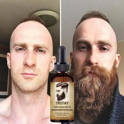 Удалить мужскую щетину, сделать бороду, щеки и волосы над губами