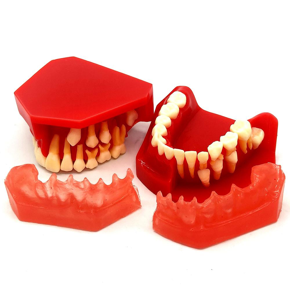 Стоматологическая детская модель молочных зубов Сменная модель Постоянные зубы Альтернативный дисплей Съемная демонстрация для обучающих моделей стоматологов