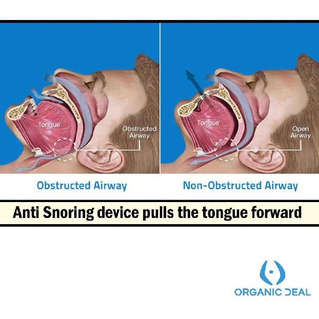 Anti Snoring Mouthpiece Tongue Retainer Helps to Eliminate Snoring Anti Snore Device Silicone Snore Sleep Apnea Anti Ronflement 3