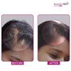 Bontress PRO+ Сыворотка для кожи головы, обогащенная Redensyl, Anagain, Capixyl, Procapil | Сыворотка для роста волос и против выпадения волос 30 мл
