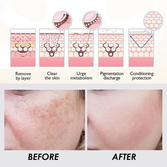 30 шт., осветляющие капсулы с ниацинамидом, сыворотка, корректирующая темные пятна, уменьшающая пятна, увлажняющая, укрепляющая эссенция для кожи