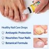 Plant Nail Care Solution 10ml Foot Care And Maintenance Nail Polish Nail Care Solution 10ml