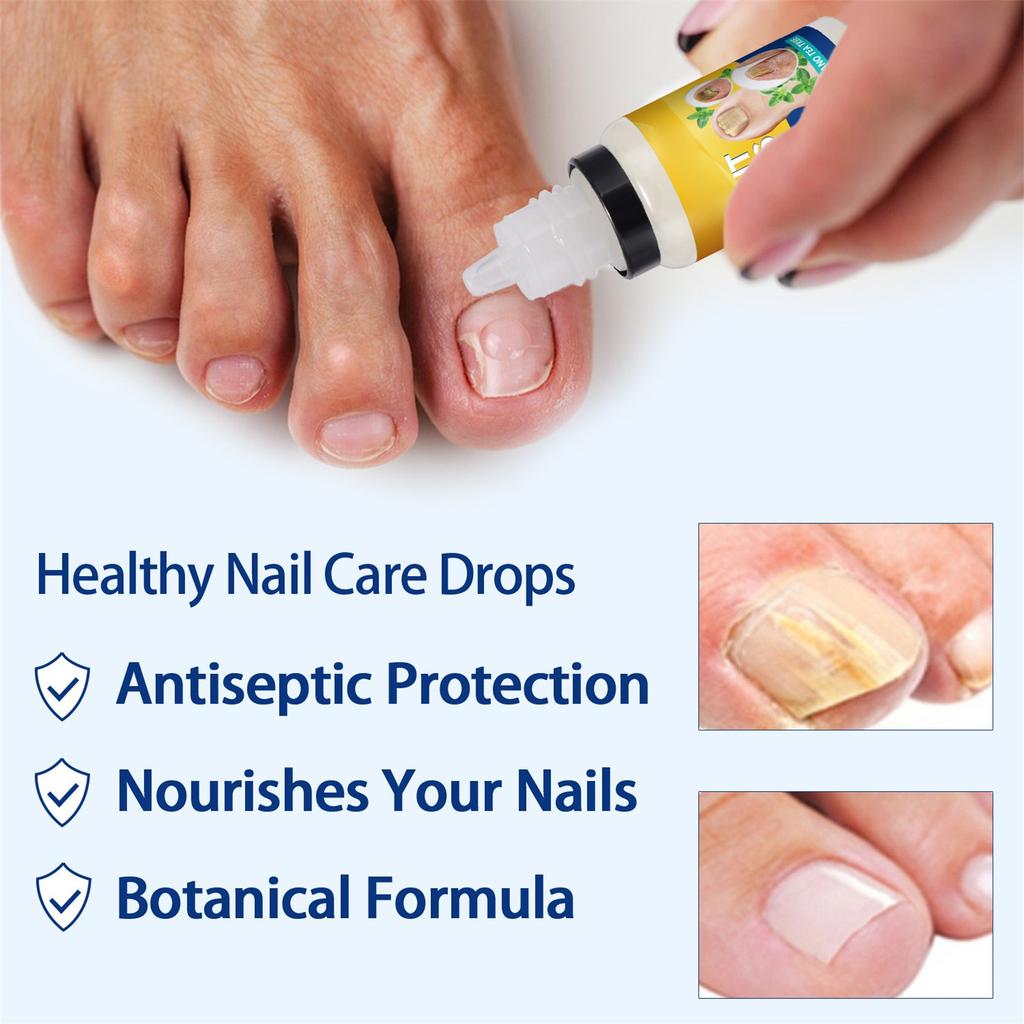 Plant Nail Care Solution 10ml Foot Care And Maintenance Nail Polish Nail Care Solution 10ml