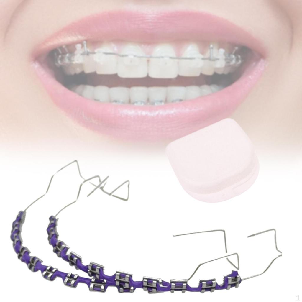 Временное украшение для зубов, практическое применение, металлические скобки для студентов