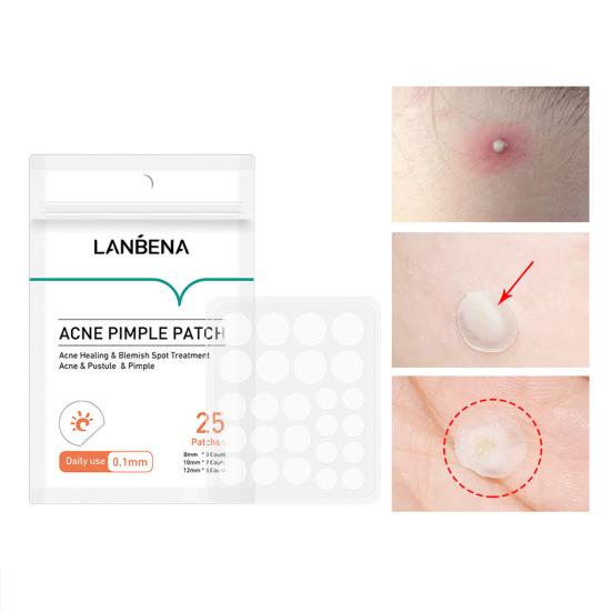 2 Packs Tea Tree Oil Day Night Acne Pimple Remover Patches Skin Care Treatment