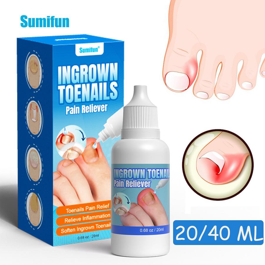 Sumifun 20/40 МЛ Жидкость для восстановления серых ногтей Облегчает серый зловонный ноготь Питает Увлажняет ногти Летний предмет первой необходимости