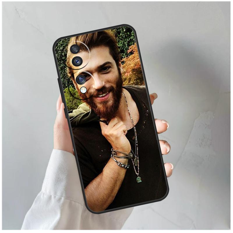 Can Yaman For Honor Magic 7 Lite 6 5 8 Pro Case For Honor X9d X9b X9c X9a X8c X8b 200 400 50 70 Win RT