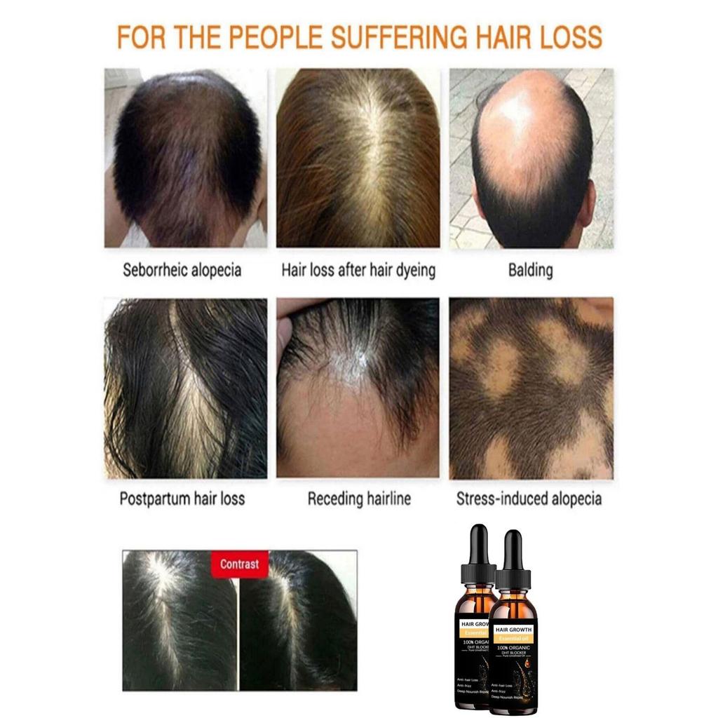 Черное касторовое масло Питает рост волос Массаж кожи Эфирное масло Рост бровей Предотвращает старение кожи Средства по уходу за волосами