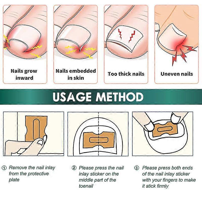 Toenail Correct, Toenail Beauty Care Stickers 50Pcs, Thin Foot Nail Surface Maintenance Patches