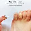 10/30/50 шт. набор силиконовых защитных накладок для пальцев ног, дышащие гелевые накладки на пальцы ног от мозолей, волдырей, вросших ногтей, облегчение боли, накладки на маленькие пальцы ног, защитные колпачки