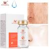 Makeup Beauty Joan Hyaluronic Acid Hydrating Moisturizing Solution, Moisturizing Skin Care Products