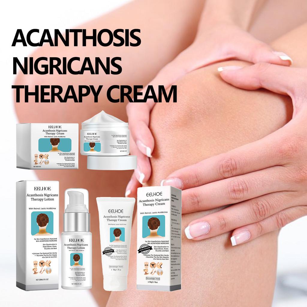 Eelhoe Серия средств для ухода за кожей «Черный терн» Увлажняющий крем для сухой, грубой и тусклой кожи 30 г