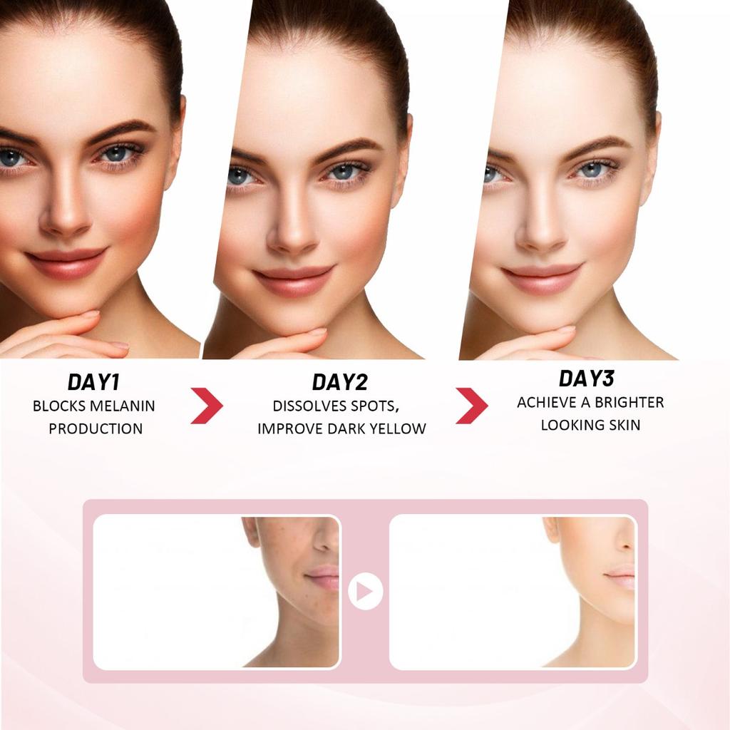 EELHOE 3-дневный увлажняющий крем с гиалуроновой кислотой - осветляет тон кожи, увлажняющий крем подтягивает и осветляет пятна