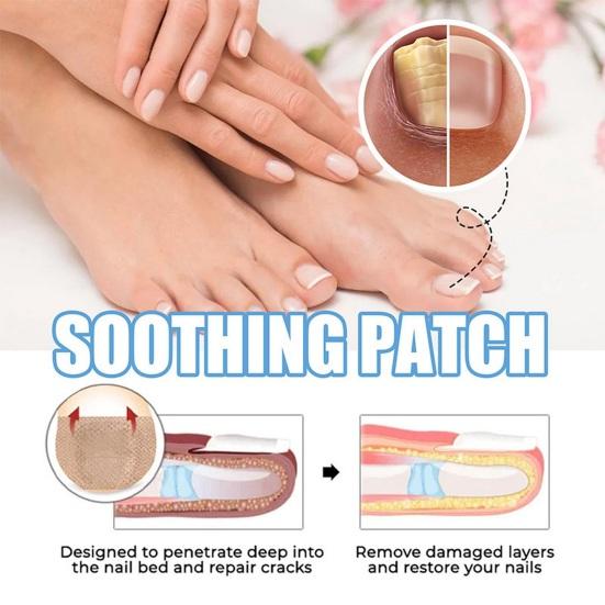 32 Pcs Nail Repair Patches Foot Patch Soft Breathable Thicken Nail Care Treatment Patch Non-irritating Toenail Remedy for Discolored Damaged Nails