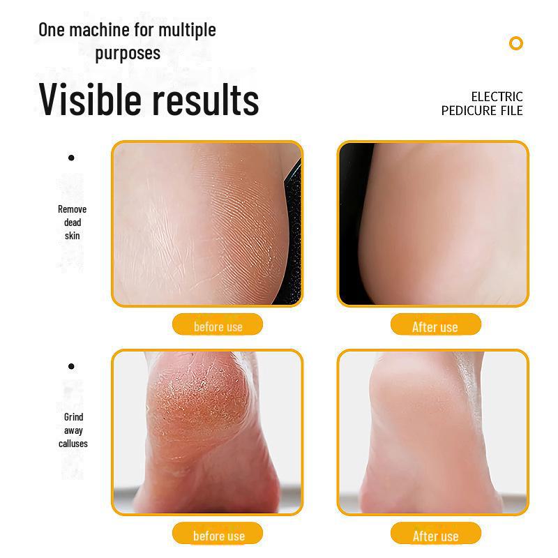 Автоматический тренажер для ног с зарядкой от USB: Удалите омертвевшую кожу и мозоли для красивых ног