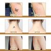 60 Patches Scar Tattoo Scald Silicone Covering Patch Skin Invisible Concealer Sticker Breathable Comfortable