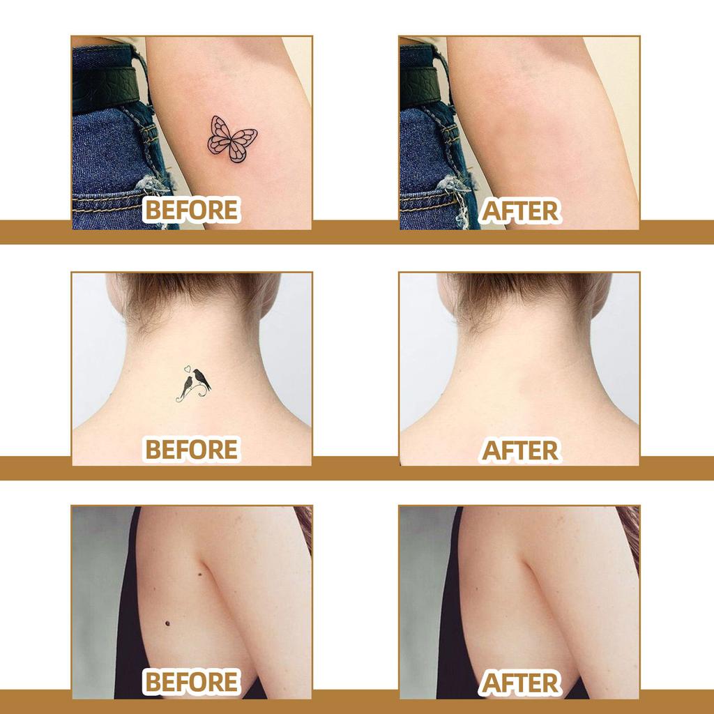 60 Patches Scar Tattoo Scald Silicone Covering Patch Skin Invisible Concealer Sticker Breathable Comfortable