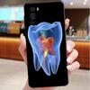 Чехол для телефона для Motorola Edge 50 40 Pro 60 50 40 30 Ultra Neo Fusion Moto G85 G72 G53 G54 G84 G13 G32 Стоматологические определения зуб