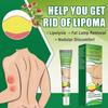 20G Fat Cream Effective Solution Effective Delicate Texture Body Care Ointment for Fat Lumps Safe Clear