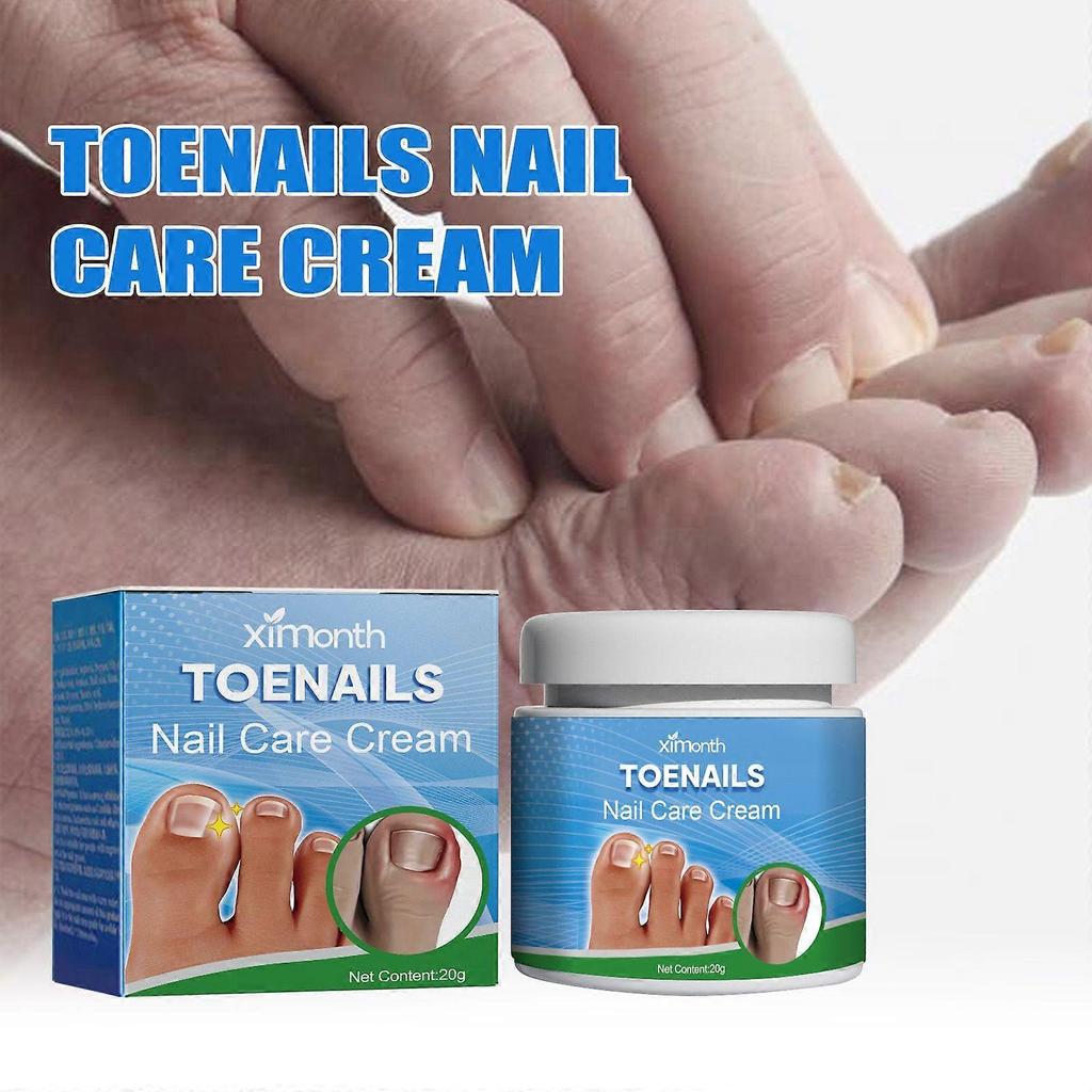 Ximonth Nail Care Cream - Repairs Gray Nails, Ingrown Nails, Soft Or Thickened Nails, Relieves Swelling And Pain