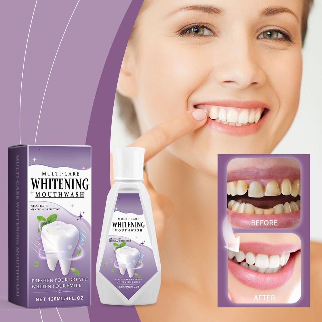 Multi-Care Whitening Mouthwash,Teeth Whitening Mouthwash,Oral Care Mouthwash, It Can Deeply Clean The Stubborn Plaque On The Surface Of Teeth(120ml)