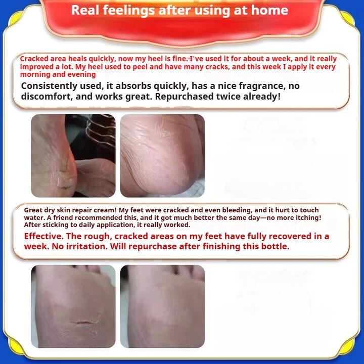 Специальный крем от трещин на руках и ногах, сухости и трещин на пятках, сухости и трещин, грибковой инфекции, трещин от обморожения