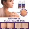 Крем от шрамов, ожогов, шрамов, шишек и геля для ухода за беременными, мягко осветляет