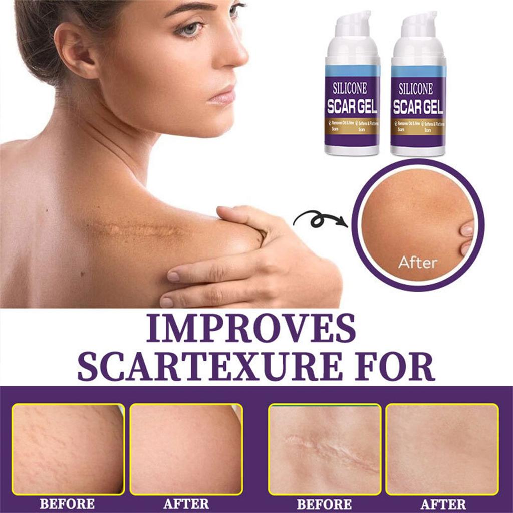 Крем от шрамов, ожогов, шрамов, шишек и геля для ухода за беременными, мягко осветляет