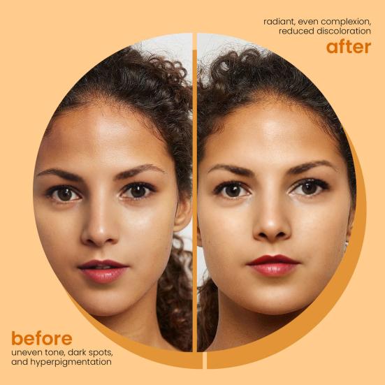 Turmeric Soap Bar for Dark Spots Acne Face Body Wash Turmeric Exfoliating Cleanser 100g Turmeric Skin Soap for All Skin Types