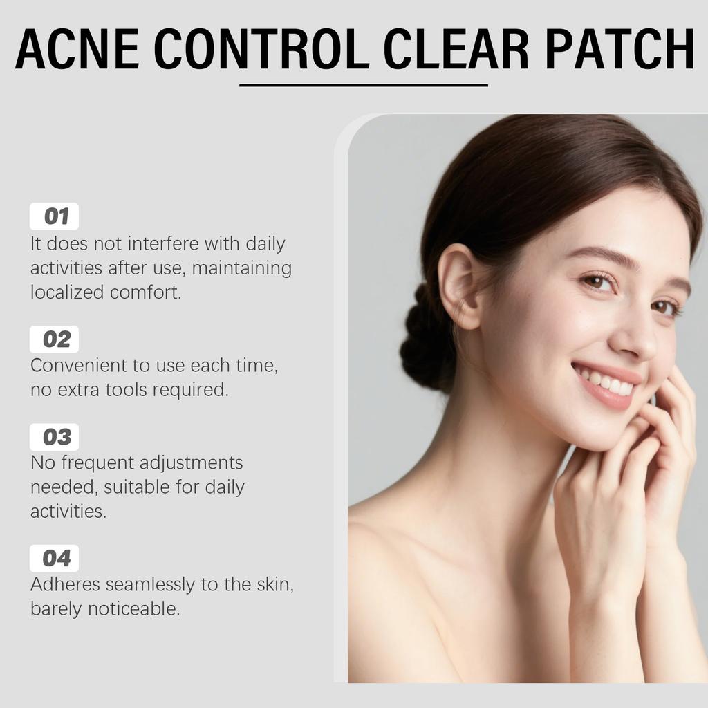 SOUTH MOON Face Acne Patch Invisible Pimple Patch Isolate Dust Prevent Picking No Makeup Caking Blemish Care