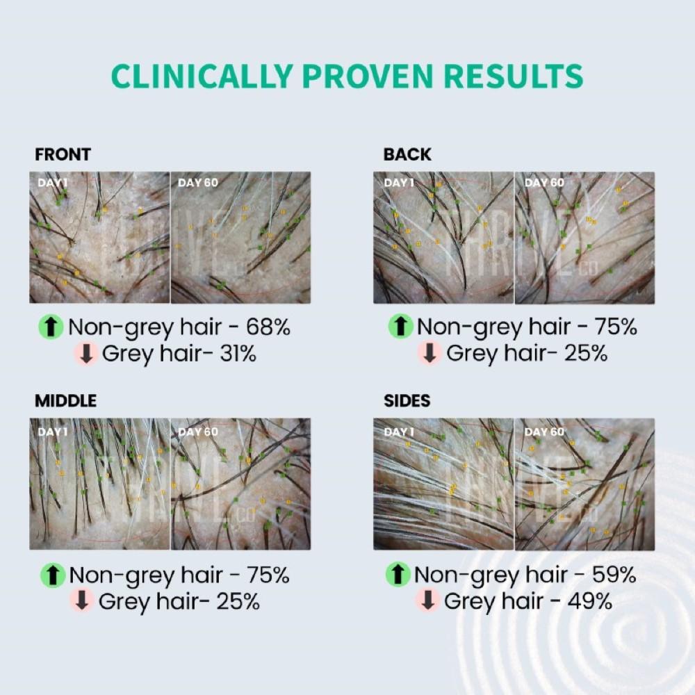 ThriveCo Прайм-сыворотка против седины для волос, 50 ​​мл | Обращает вспять преждевременное поседение