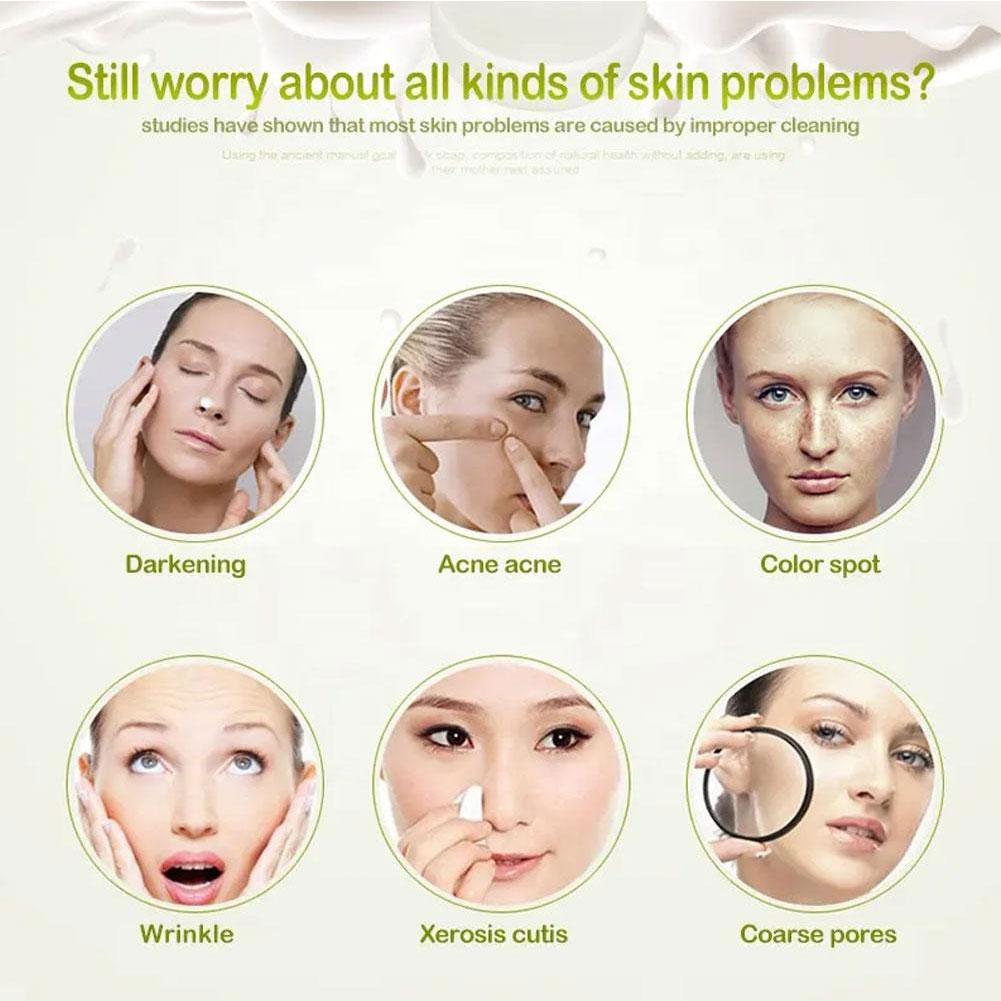 Мыло для отбеливания тела Подмышки Мыло для отбеливания колен Курица Темное тело Уход за мертвыми точками Осветление Mois P2X9