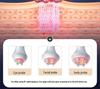 80K Six-in-One Beauty Instrument: Body Slimming, Multi-polar Massage, Negative Pressure, Gua Sha, Dredging, Sculpting