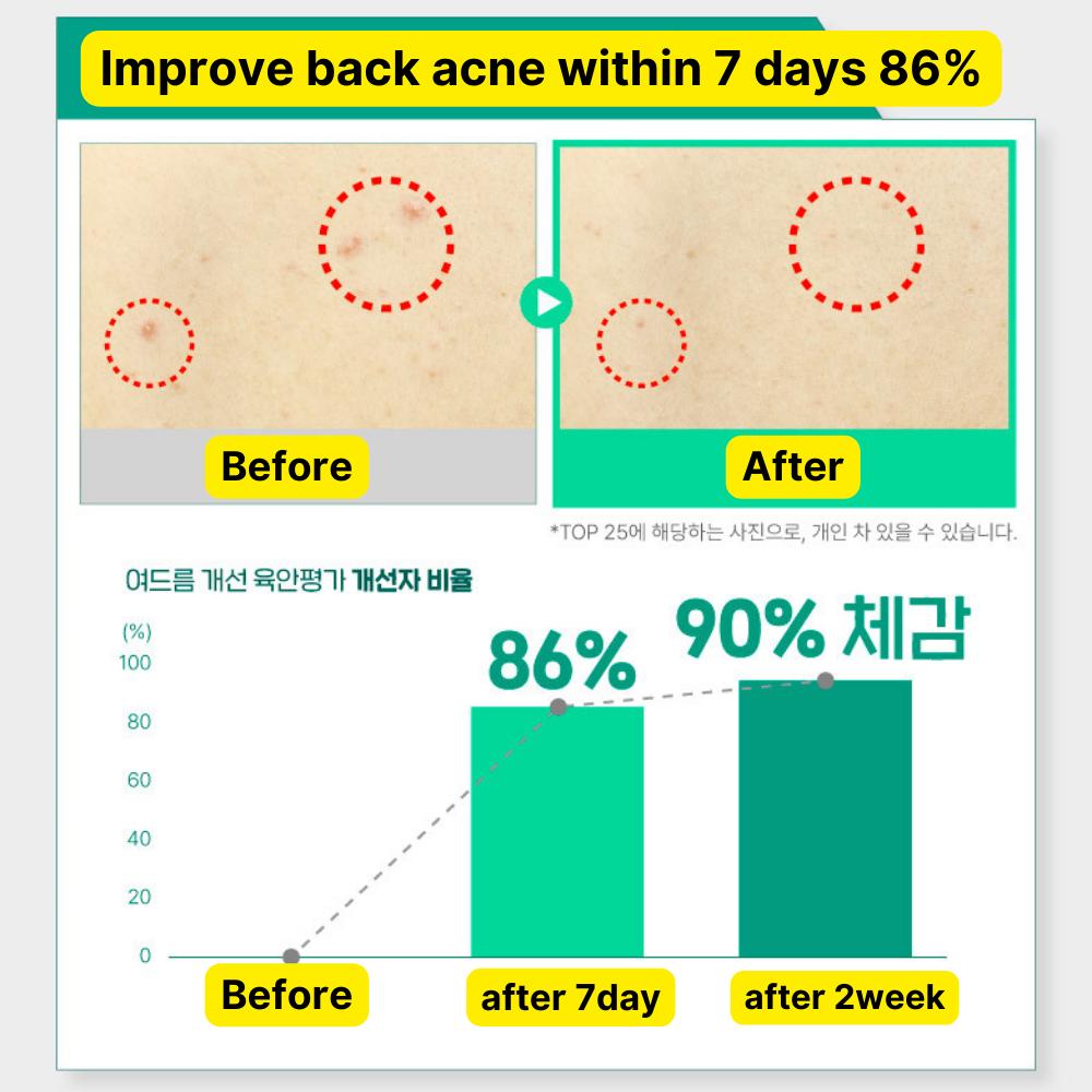 ILLIYOON Cica Acne Clear Peeling Scrub 200 г