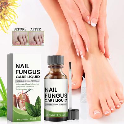 Лечение грибка ногтей на ногах Extra Strong, NailTreatment, Средство по уходу за ногтями Extra Strong для толстых, обесцвеченных и поврежденных ногтей, 30 мл