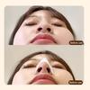 1/2Pcs Thermoplastic Nasal Splints Trapezoid Nose Brace External Nasal Support for Fracture Rhinoplasty Surgery ENT Immobilization