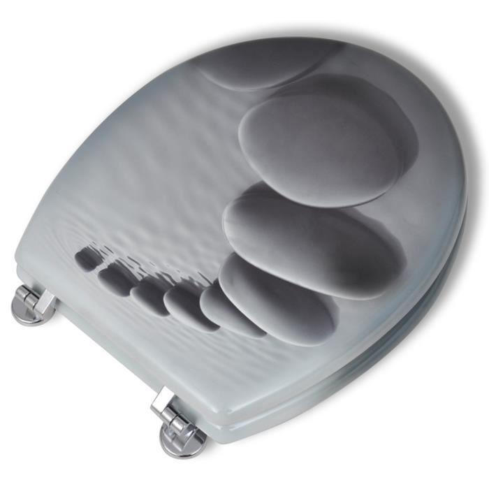 VidaXL Toilet Seat with Lid MDF Stones
