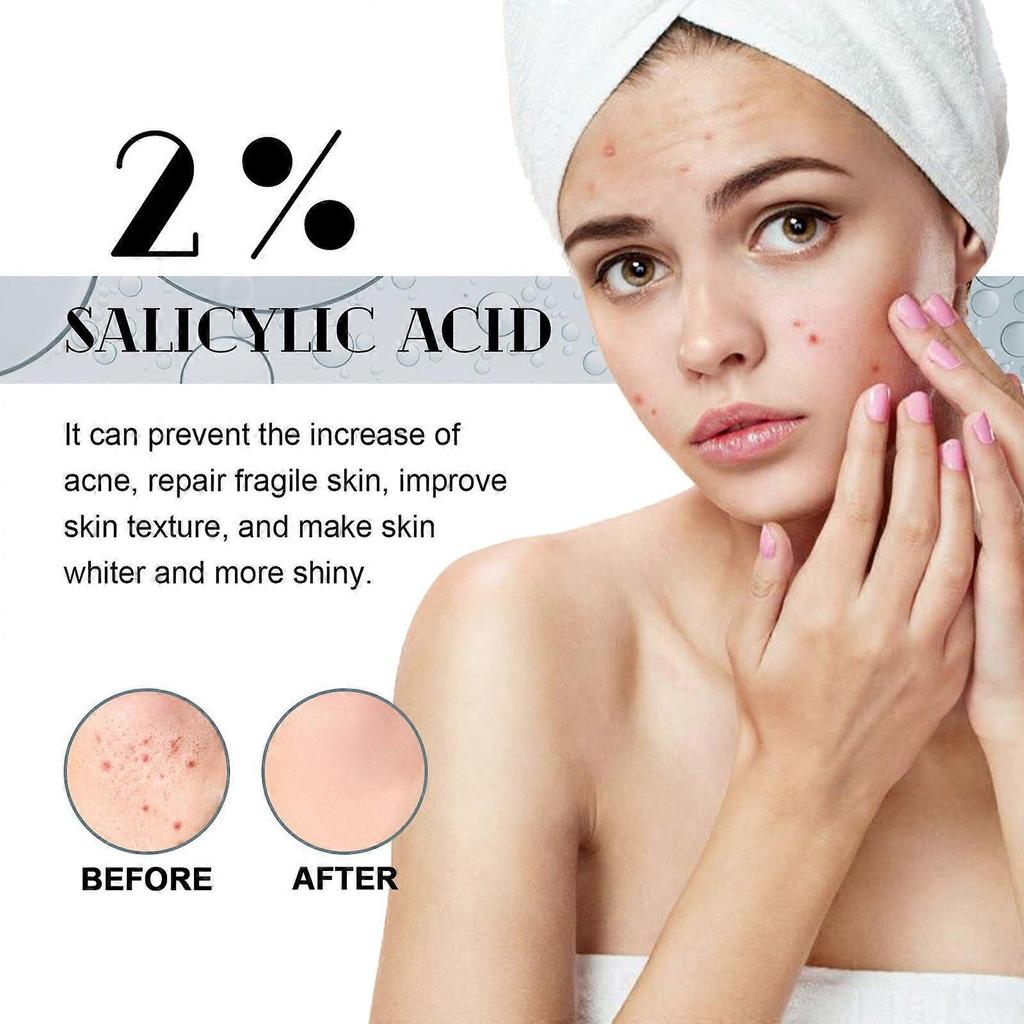 Salicylic face serum, face serum with salicylic acid, anti-imperfection serum contrasts black spots and bruises, face serum reduces thin lines