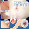 Silicone Scar Sheets Reusable Scar Removal Strips for Post-Surgery Acne Breathable Waterproof Scar Tape