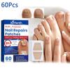 60Pcs Toenail Fungus Treatment Patches Sticky Nail Ingrown Care Correction Stickers for Paronychia Nail Repair