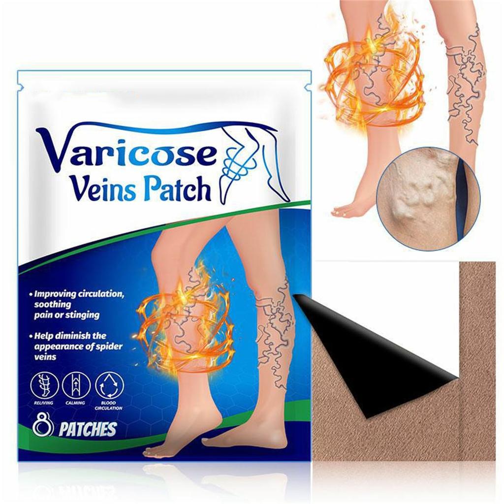 Varicose Vein Patch Vasculitis, Phlebitis, Vascular Swelling, Best Teatment, Ointment, Skin Care Patch 8pc