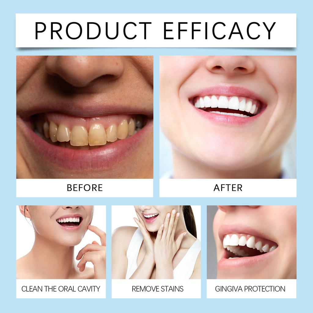 Освежающая отбеливающая зубная пудра глубоко очищает зубы, заботится о свежем дыхании и обеспечивает ежедневную гигиену полости рта.. Он мягкий и не вызывает раздражения.