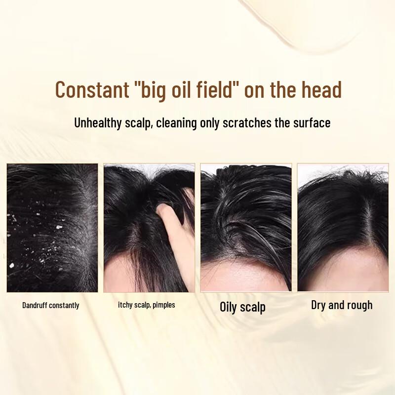 QINGYAN Sulfur Anti-Dandruff & Oil Control Shampoo