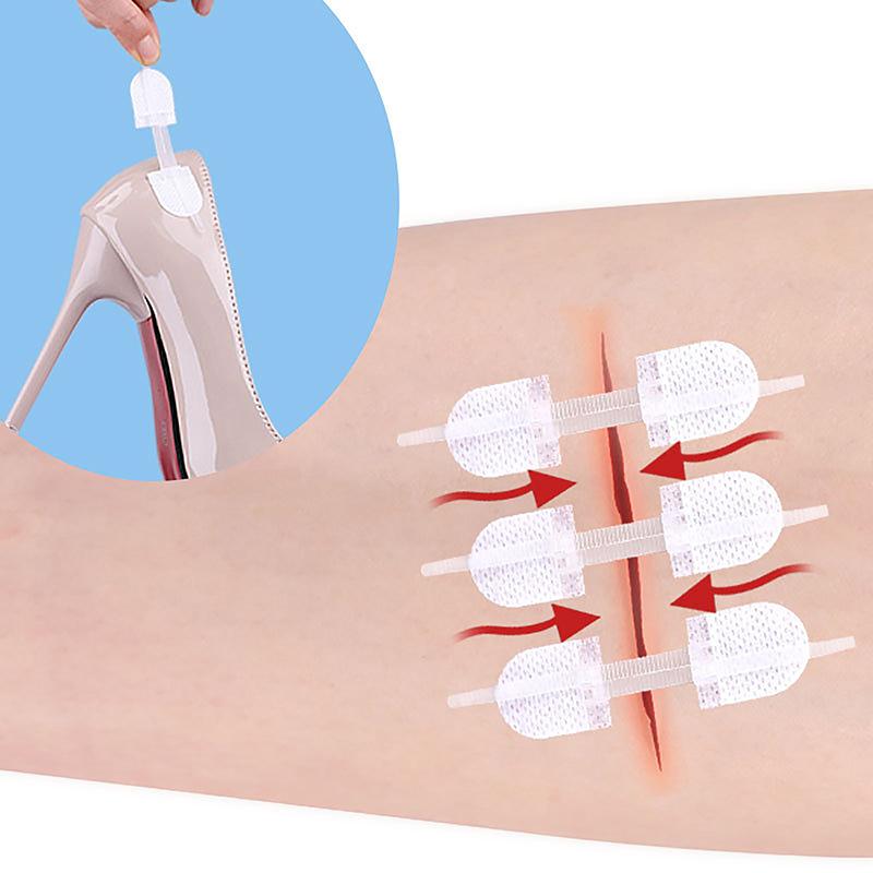 Застежка-молния Заплатка для закрытия раны Гемостатическая заплата для быстрого шва на ране Лента на молнии