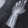 Европейский и американский стритстайл Череп Прямая печать Стирка Худи Мужской и женский Свободный Ретро Модный Бренд Старое пальто