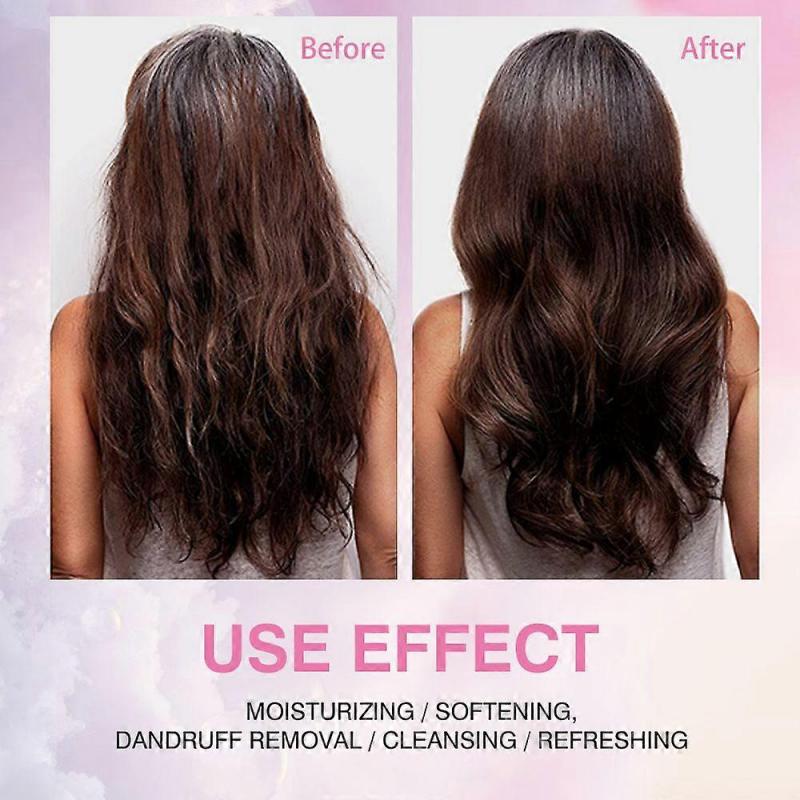 2 шт. Шампунь с биотином и розмарином для волос, Натуральный уход за волосами, Шампунь для роста, Подходит для всех типов волос, Уменьшение выпадения волос, Стимулирование роста волос