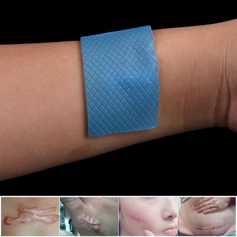 1 шт., терапия шрамов, удаление ожогов, силиконовый пластырь, многоразовый гель от прыщей, ремонт кожи