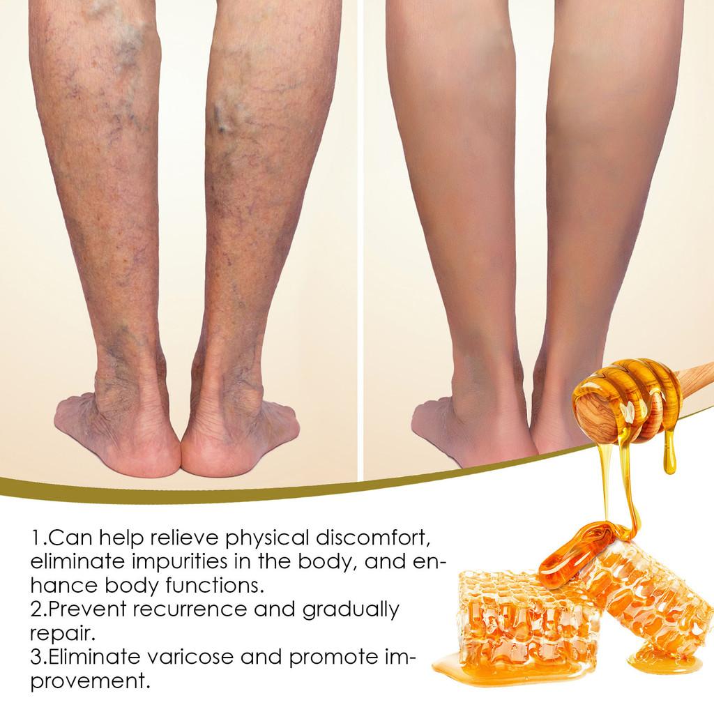 Natural Bee Venom Foot Soak Pearls Relieve Leg Discomfort Cleanse Moisturize