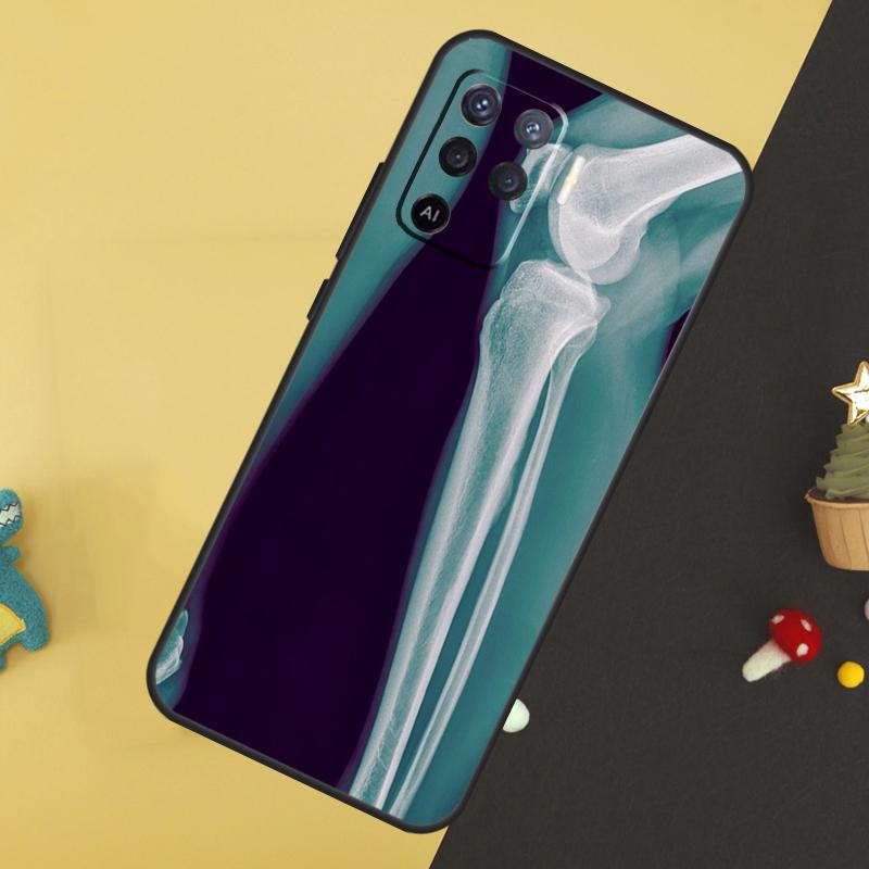 Чехол-кейс с рентгеновским изображением анатомии человека для Oppo A80 A60 A40 A54 A74 A94 A18 A38 A58 A78 A98 A96 A76 A16 A15 A17 A57 A5 A6 Pro